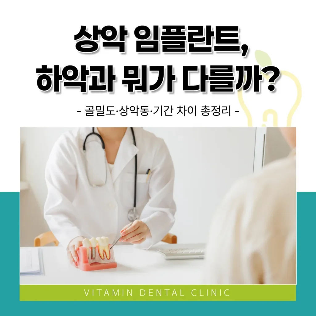 상악 임플란트, 하악과 뭐가 다를까? 골밀도·상악동·기간 차이 총정리 | 울산 중구 비타민치과