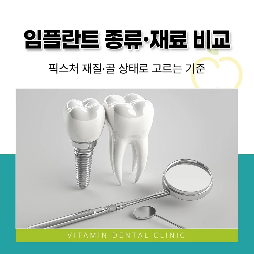 임플란트 종류·재료 비교(울산 중구) | 픽스처 재질·골 상태로 고르는 기준
