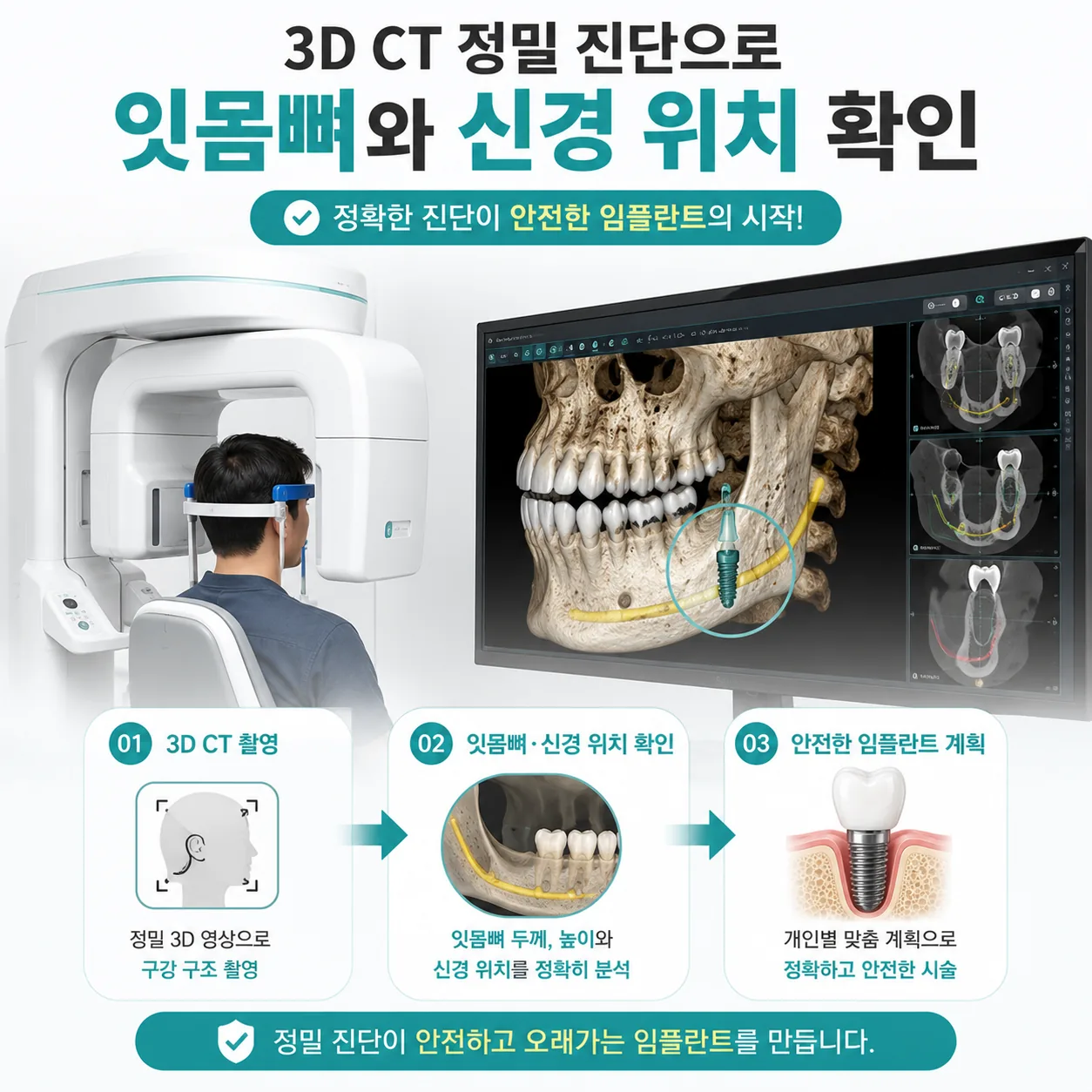 임플란트 3D CT 정밀 진단으로 잇몸뼈 신경 위치 확인