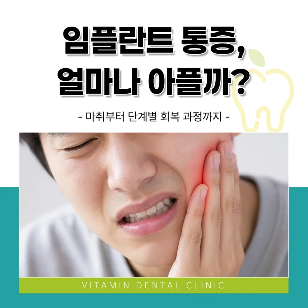 임플란트 통증, 얼마나 아플까? 마취부터 단계별 회복 과정까지 (울산 중구)