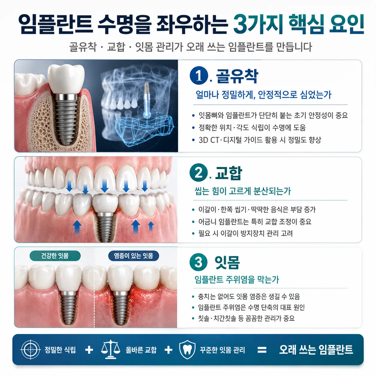 임플란트 수명을 좌우하는 골유착 교합 잇몸 요인
