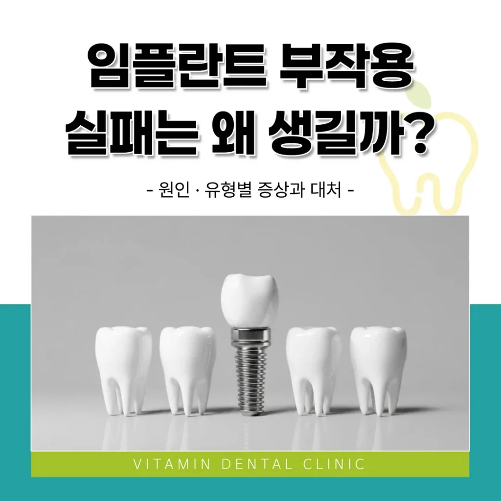 임플란트 부작용·실패는 왜 생길까? 원인·유형별 증상과 대처 (울산 중구)