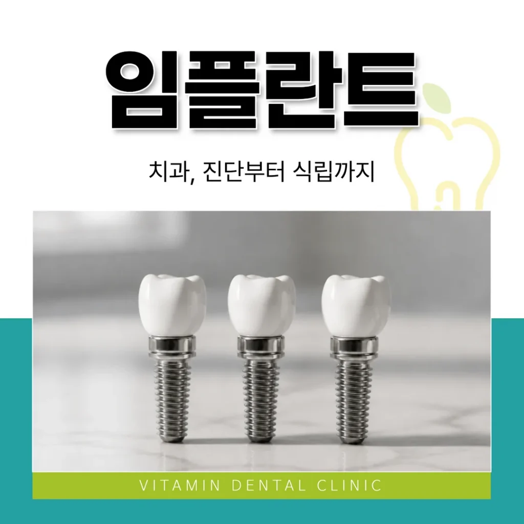 울산 중구 임플란트 치과, 진단부터 식립까지|비타민치과 통합치의학과 전문의
