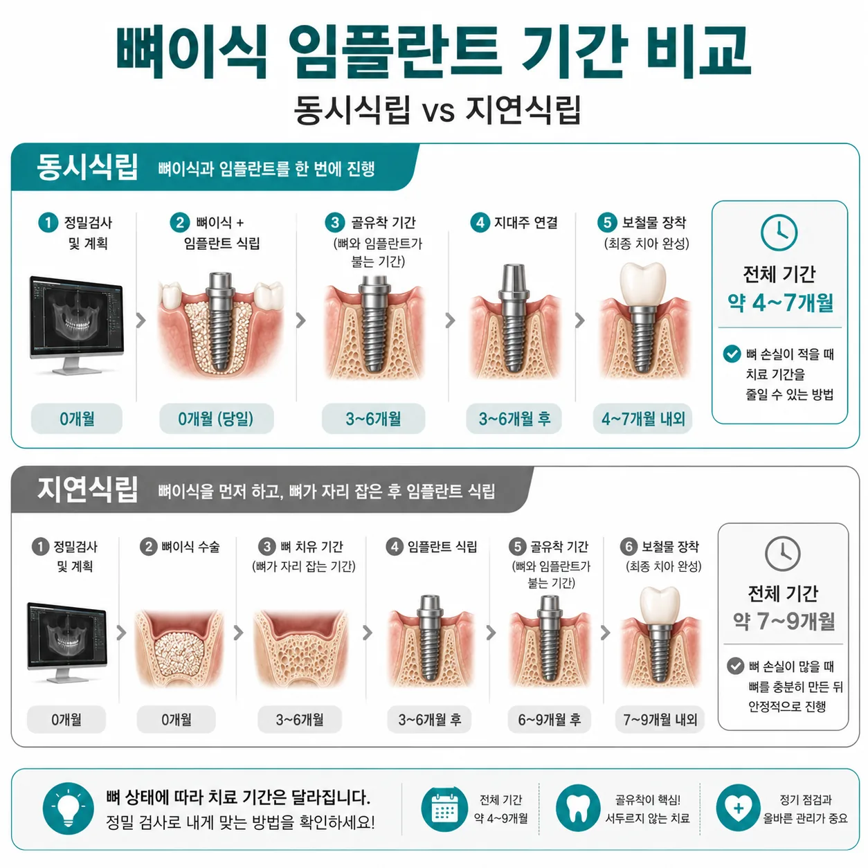 뼈이식 임플란트 동시식립과 지연식립 기간 타임라인 비교