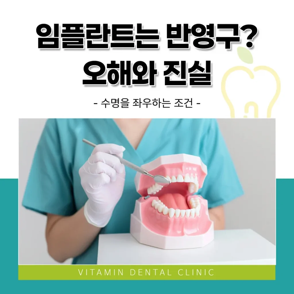“임플란트는 반영구”? 오해와 진실 — 수명을 좌우하는 조건 (울산 중구)