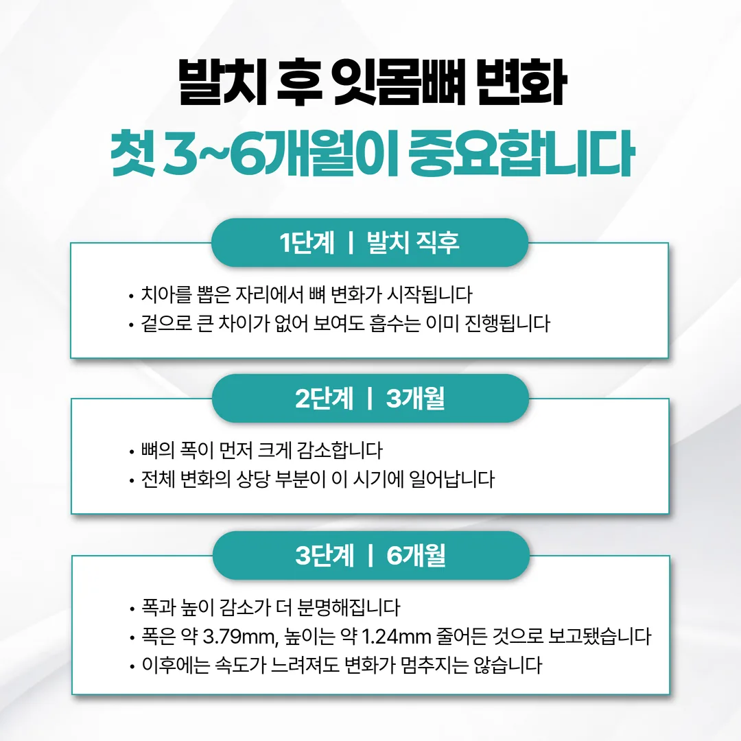 발치 후 3개월과 6개월 시점의 치조골 폭·높이 감소를 비교한 도식