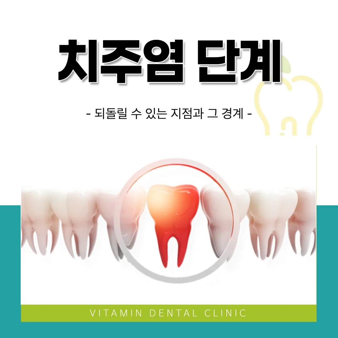 치주염 단계 — 되돌릴 수 있는 지점과 그 경계