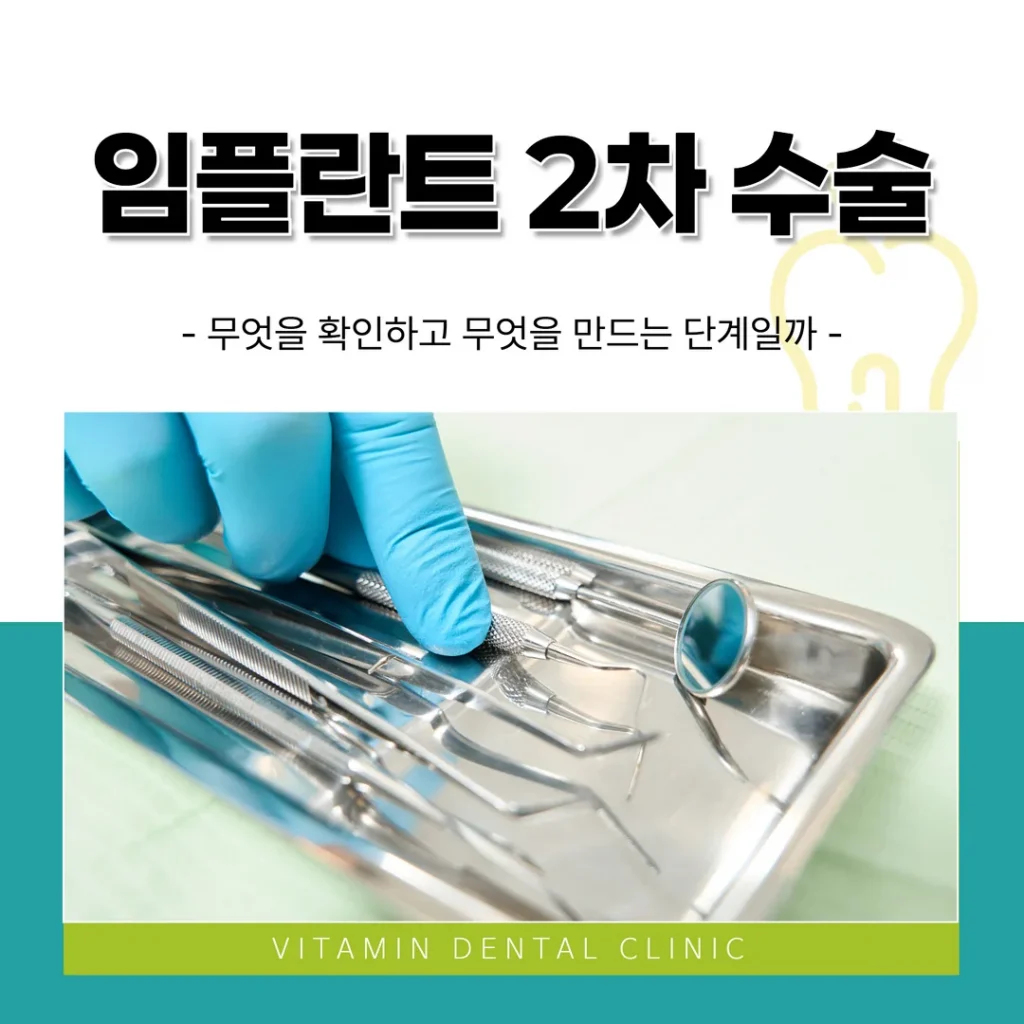 임플란트 2차 수술, 무엇을 확인하고 무엇을 만드는 단계일까