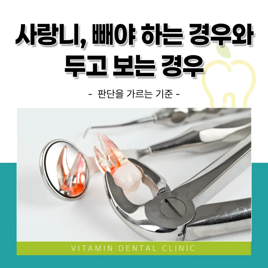 사랑니, 빼야 하는 경우와 두고 보는 경우 — 판단을 가르는 기준