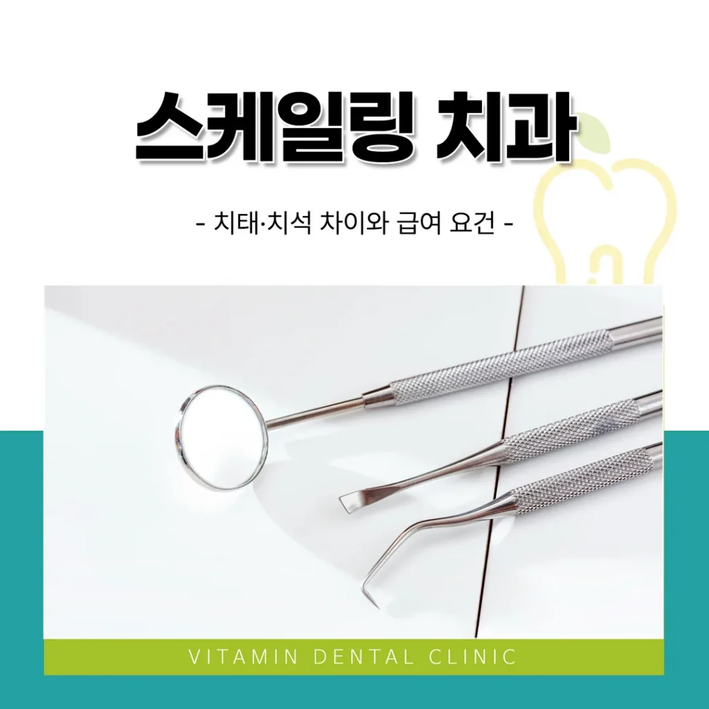 울산 중구 스케일링치과 | 치태·치석 차이와 급여 요건