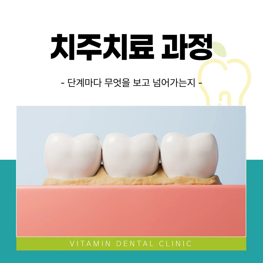 치주치료 과정 — 단계마다 무엇을 보고 넘어가는지