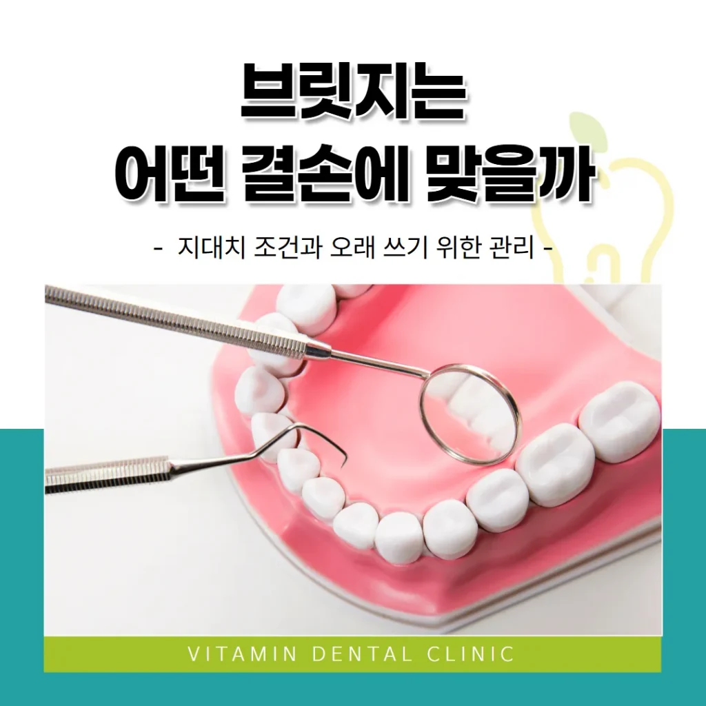 브릿지는 어떤 결손에 맞을까 — 지대치 조건과 오래 쓰기 위한 관리