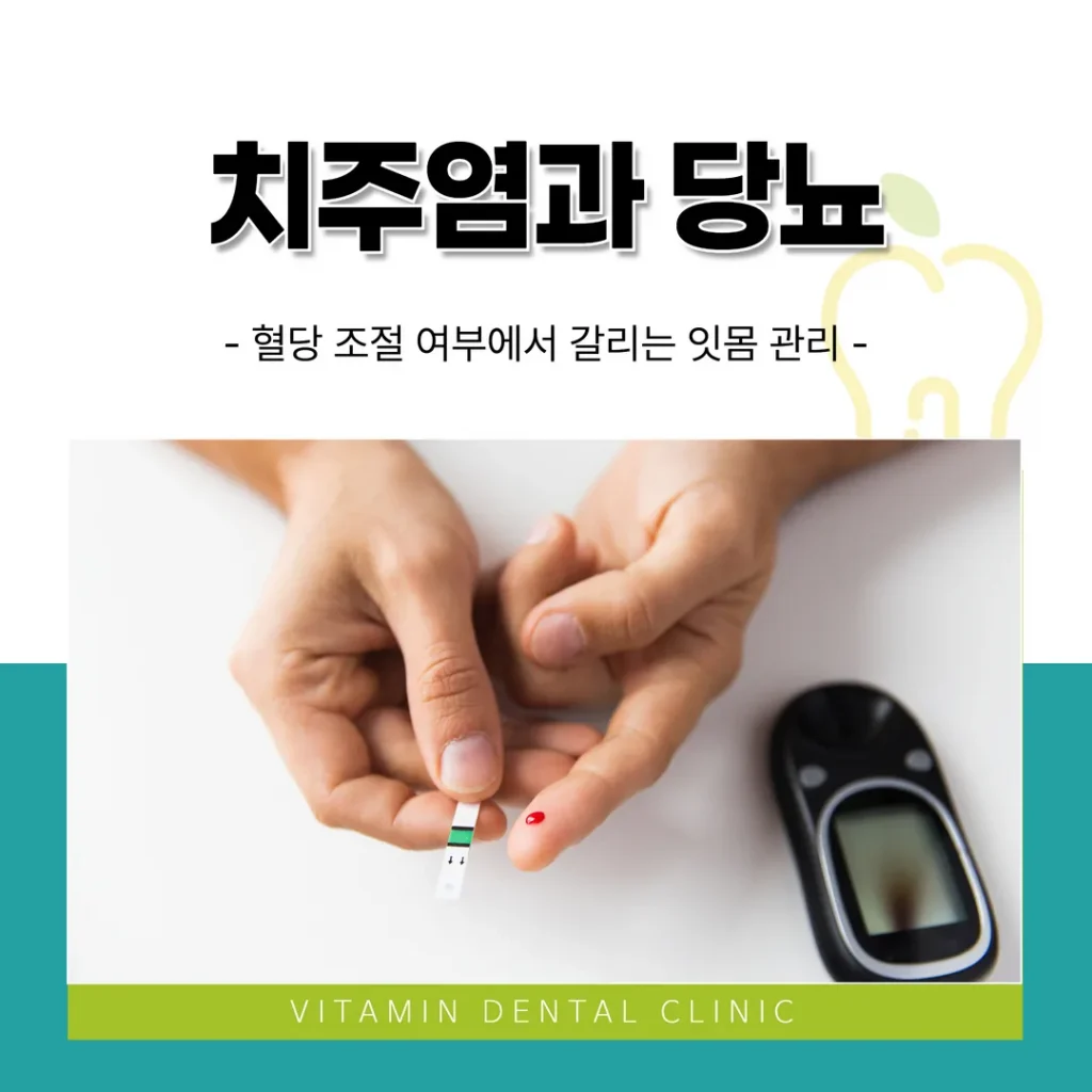 치주염과 당뇨 — 혈당 조절 여부에서 갈리는 잇몸 관리