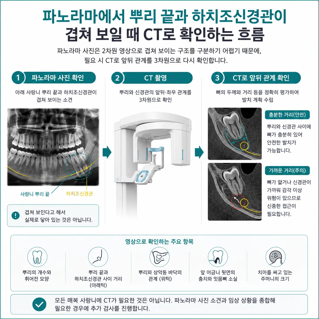 파노라마에서 뿌리 끝과 하치조신경관이 겹쳐 보일 때 CT로 확인하는 흐름 도해