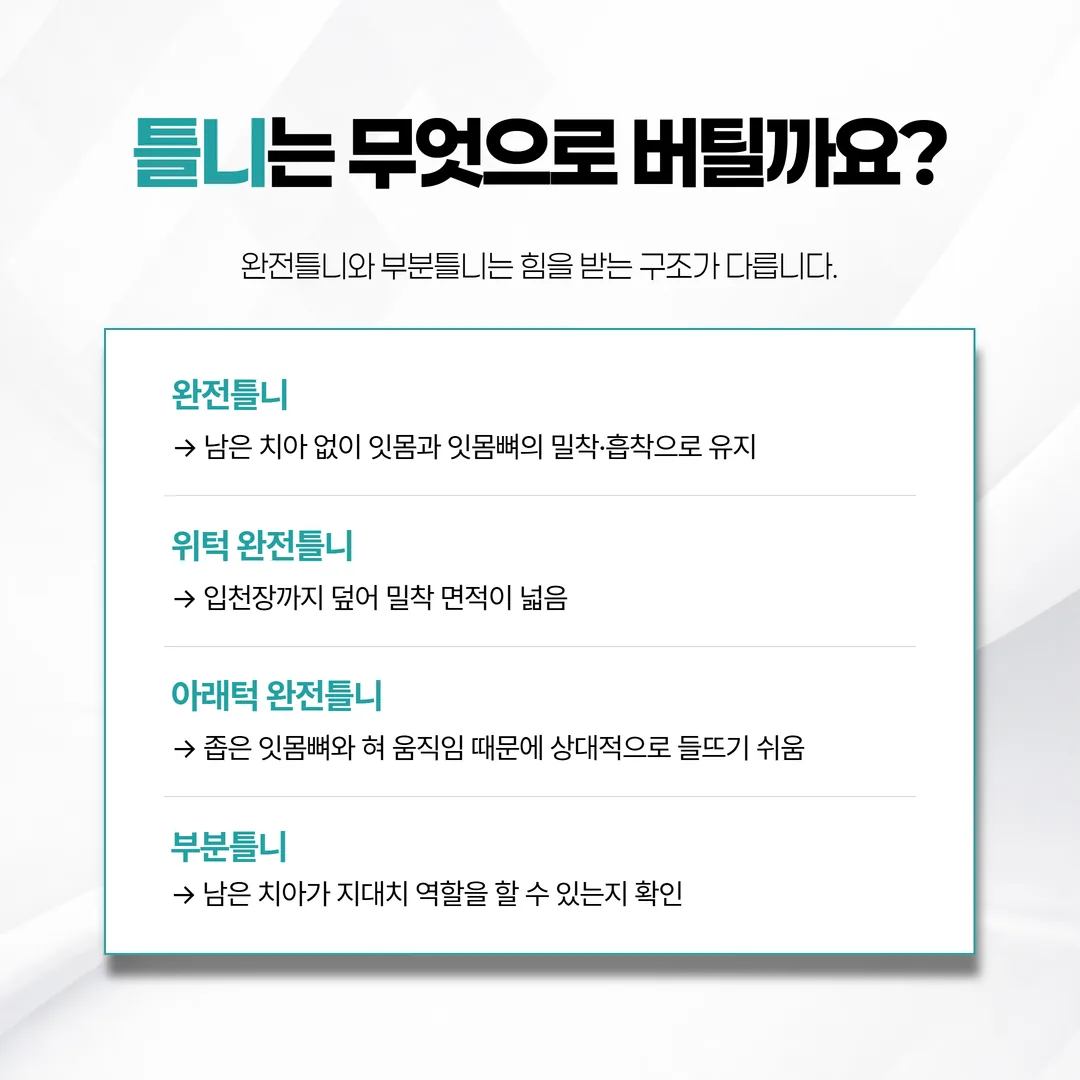 부분틀니 유지 장치 방식 비교 그림