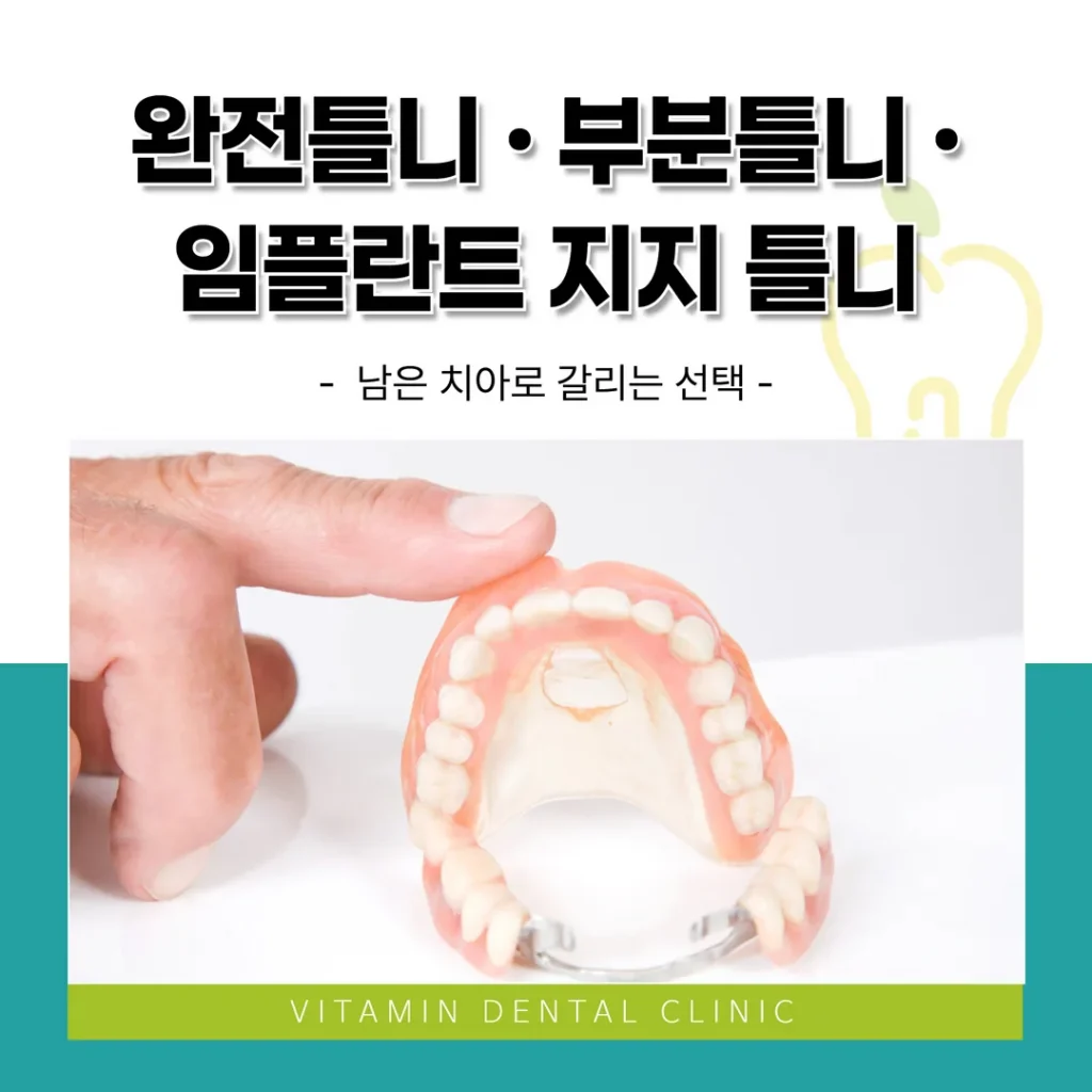 완전틀니·부분틀니·임플란트 지지 틀니 — 남은 치아로 갈리는 선택