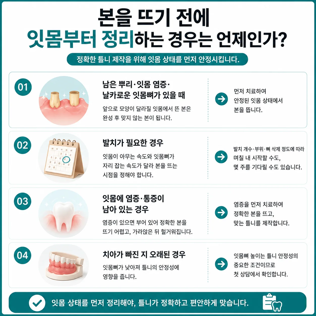 틀니 정밀 인상 채득 준비 장면