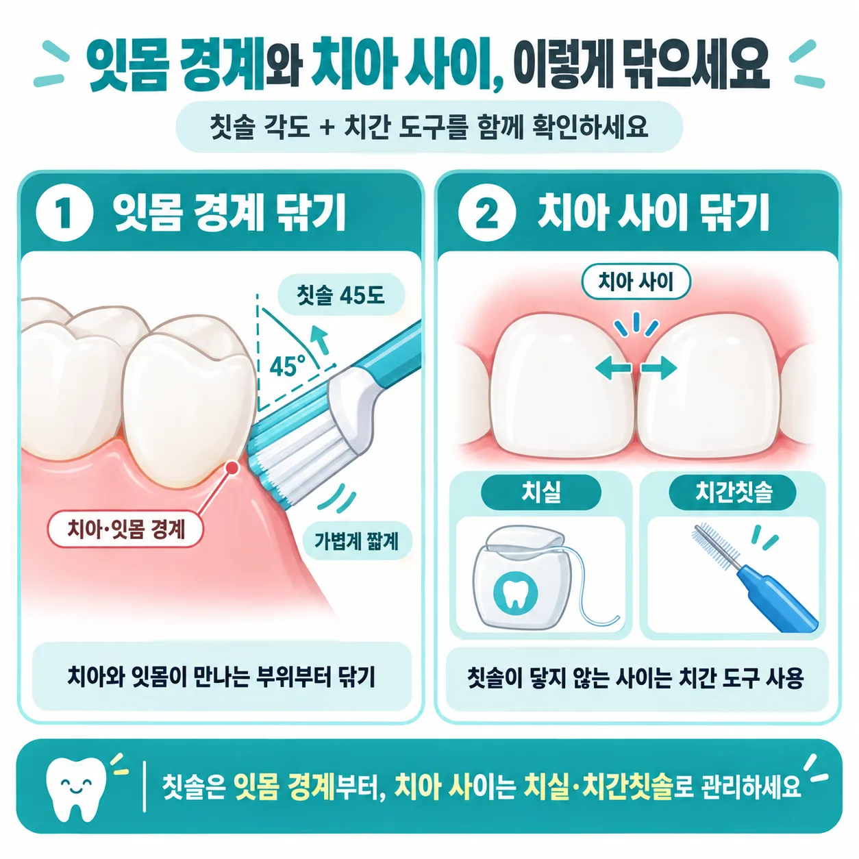 잇몸 경계와 치아 사이를 닦는 칫솔 각도와 치간 도구 도식