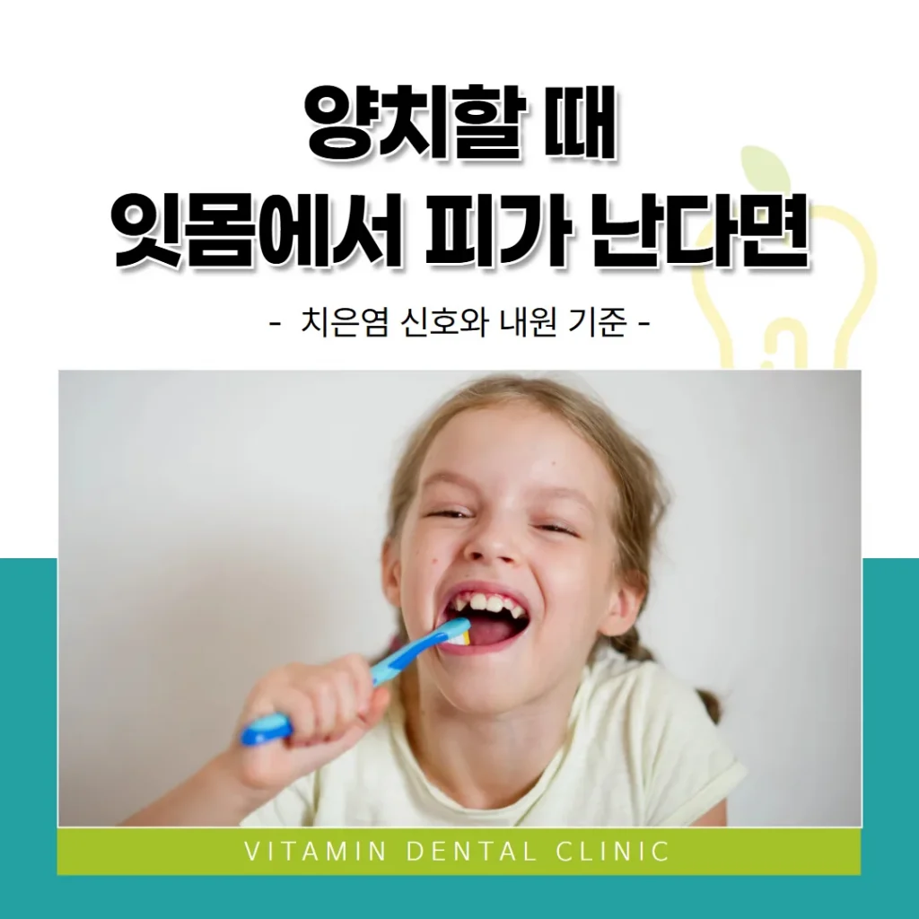 양치할 때 잇몸에서 피가 난다면 — 치은염 신호와 내원 기준