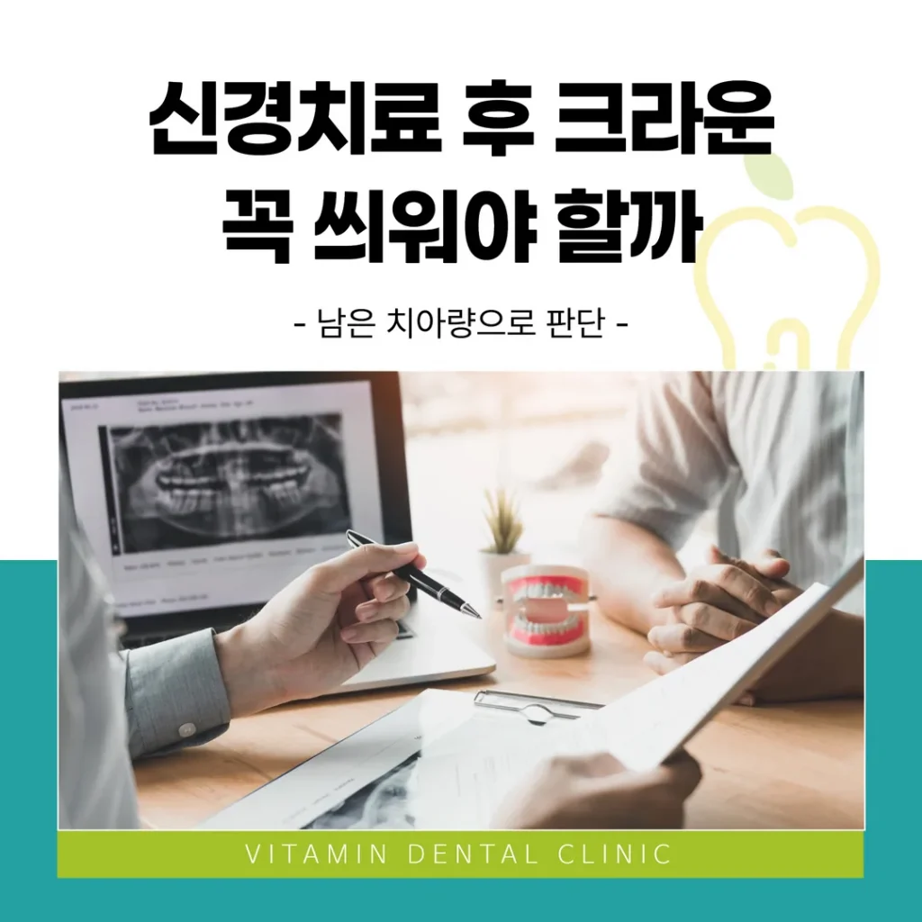 신경치료 후 크라운, 꼭 씌워야 할까 — 남은 치아량으로 판단