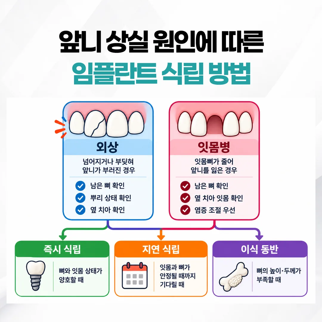 앞니 상실 원인에 따라 식립 시기가 즉시, 지연, 이식 동반으로 갈리는 판단 흐름 도식