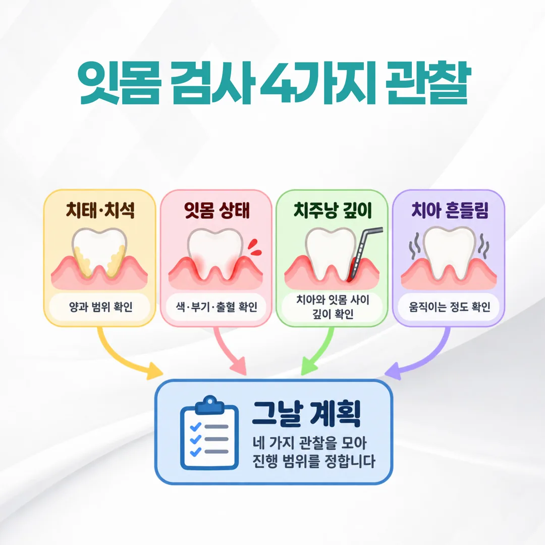 잇몸 검사 네 가지 관찰이 하나의 진료 계획으로 모이는 개념도