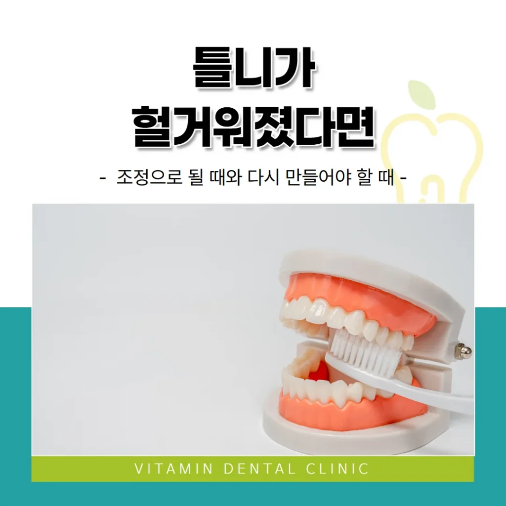 틀니가 헐거워졌다면 — 조정으로 될 때와 다시 만들어야 할 때