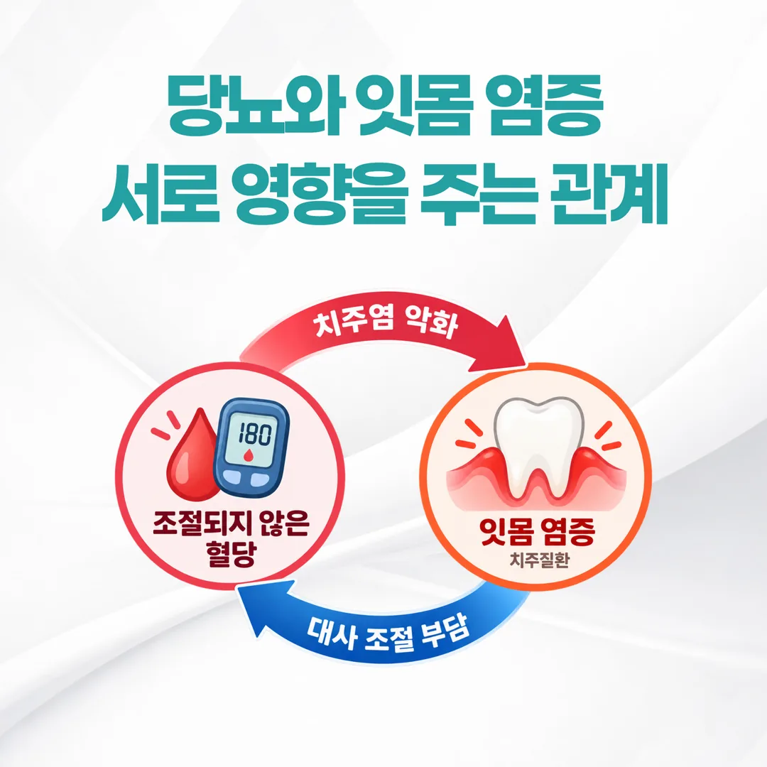 당뇨와 치주질환이 서로 영향을 주고받는 관계 개념도