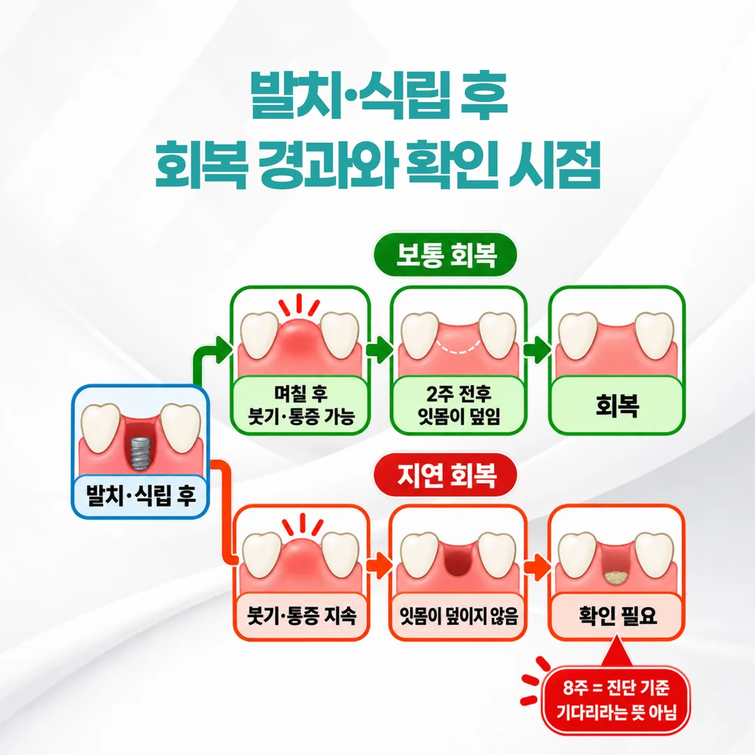 발치·식립 자리의 정상 회복과 지연 회복이 갈리는 시점을 나타낸 도식