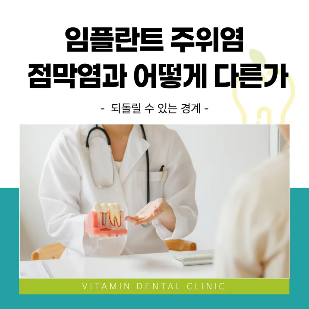 임플란트 주위염, 점막염과 어떻게 다른가 — 되돌릴 수 있는 경계