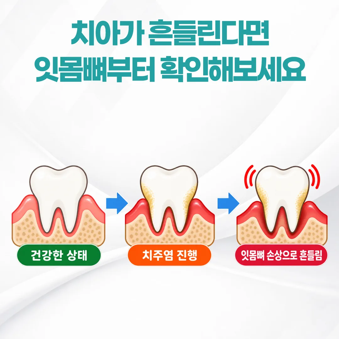치주낭 깊이와 치아 동요도 측정 및 방사선 촬영으로 이어지는 잇몸 검사 순서도