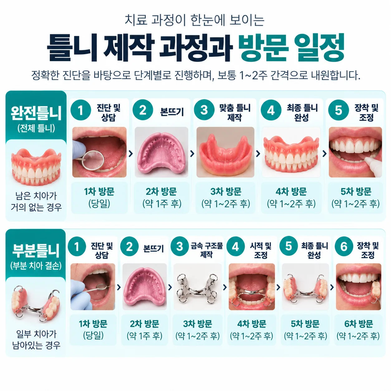 완전틀니 5단계와 부분틀니 6단계 제작 과정 일정 도표