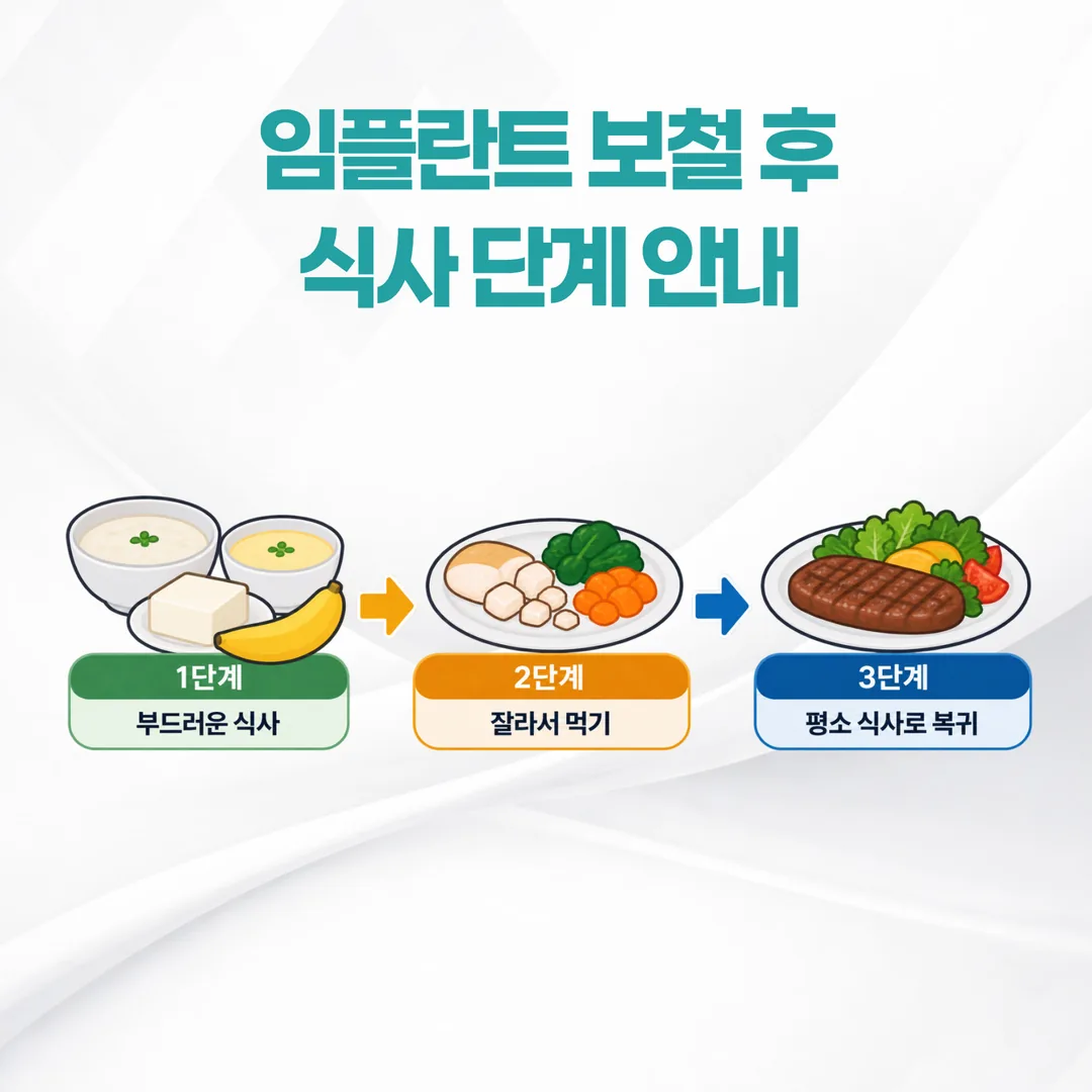 임플란트 보철 장착 후 부드러운 식사에서 평소 식사로 넓혀가는 단계 그림