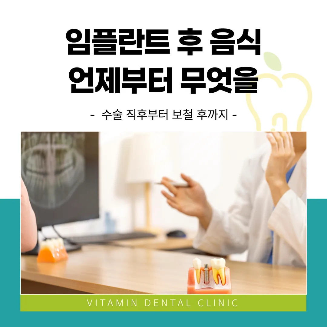 임플란트 후 음식, 언제부터 무엇을 — 수술 직후부터 보철 후까지