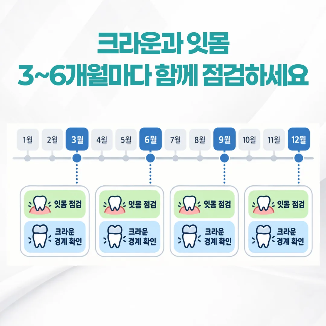 잇몸 점검 일정에 크라운 경계 확인을 함께 넣는 연간 점검 주기 도식