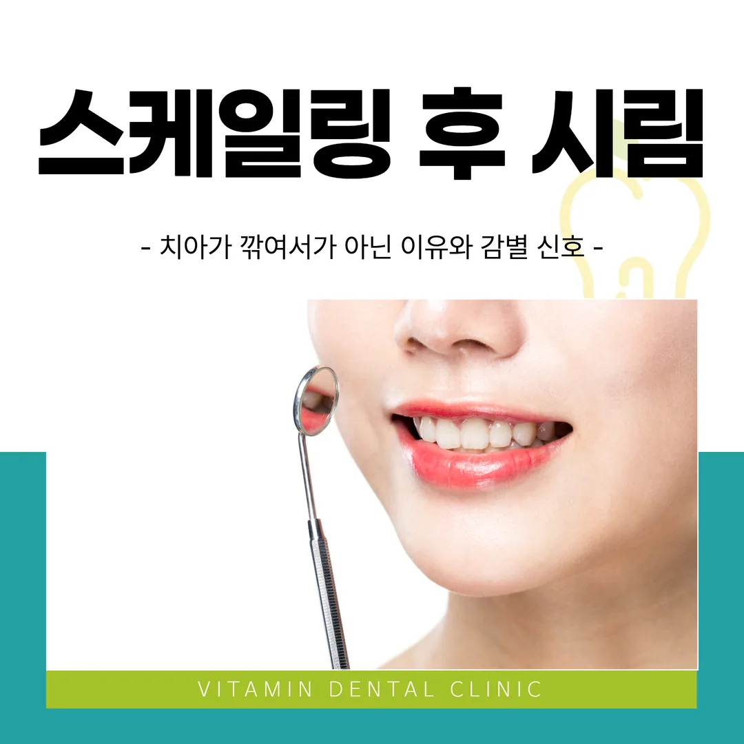 스케일링 후 시림 — 치아가 깎여서가 아닌 이유와 감별 신호