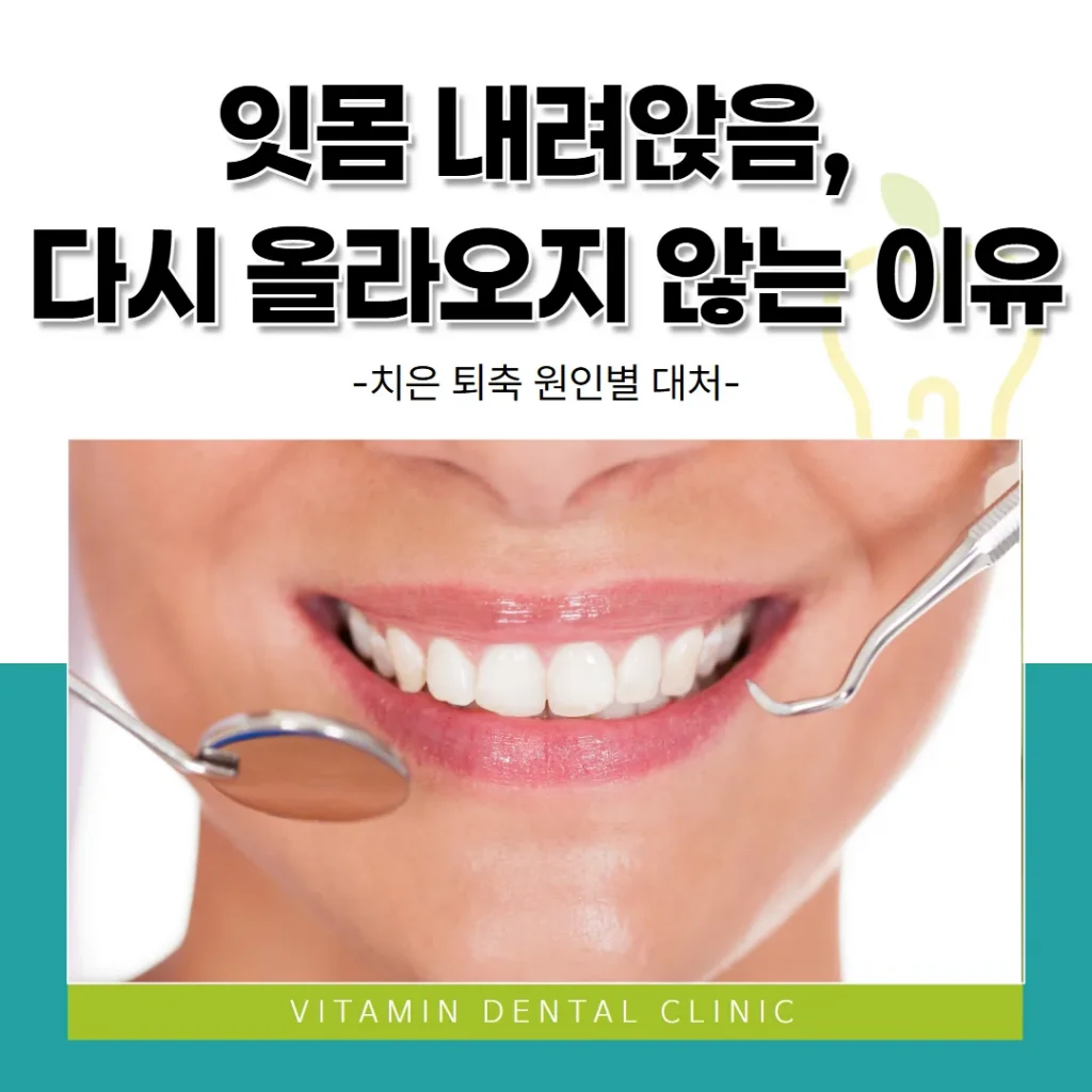 잇몸 내려앉음, 다시 올라오지 않는 이유 — 치은 퇴축 원인별 대처