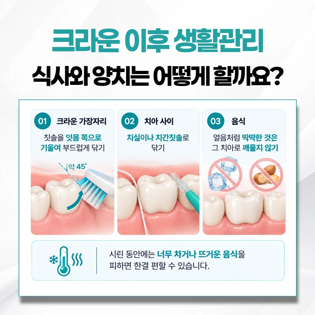 크라운 씌운 뒤 적응 기간의 양치 방법과 식사 요령을 세 칸으로 나눈 그림