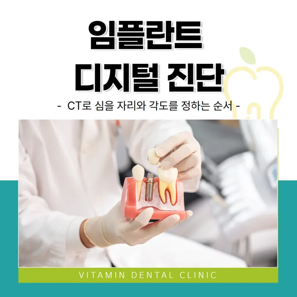 임플란트 디지털 진단, CT로 심을 자리와 각도를 정하는 순서