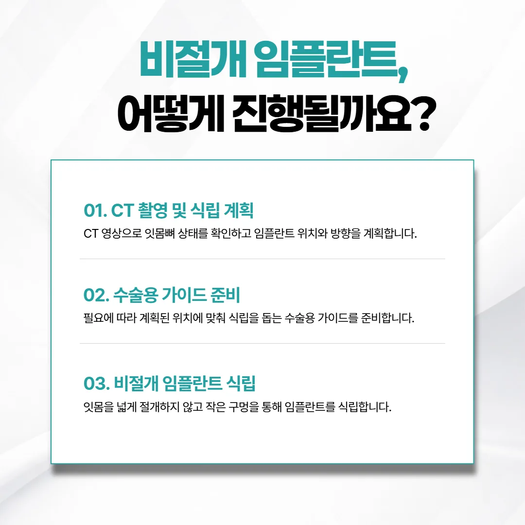 CT로 세운 계획이 수술용 가이드를 거쳐 비절개 식립으로 이어지는 흐름도