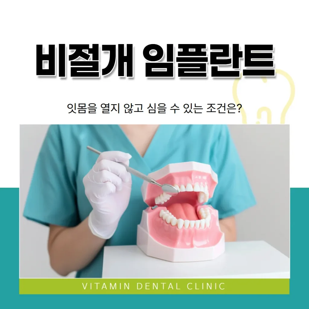 비절개 임플란트, 잇몸을 열지 않고 심을 수 있는 조건은?