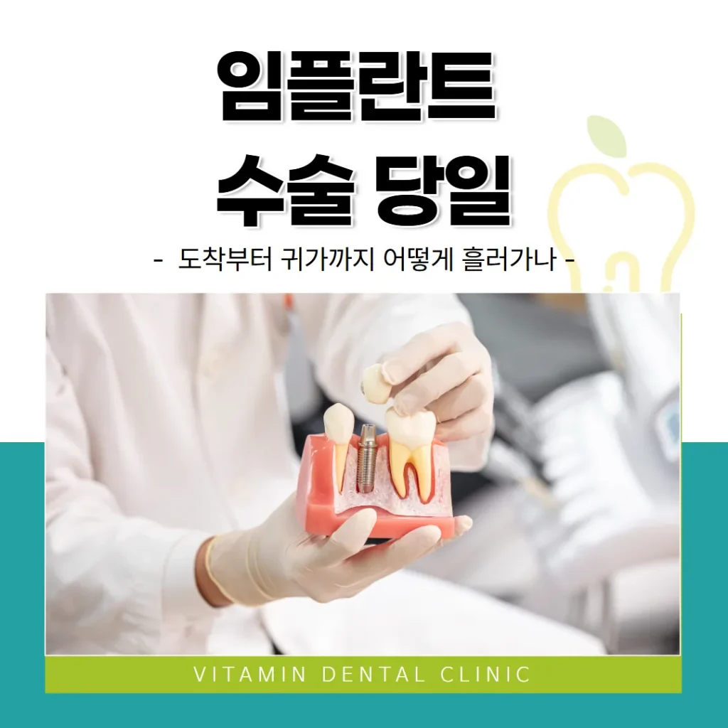임플란트 수술 당일, 도착부터 귀가까지 어떻게 흘러가나