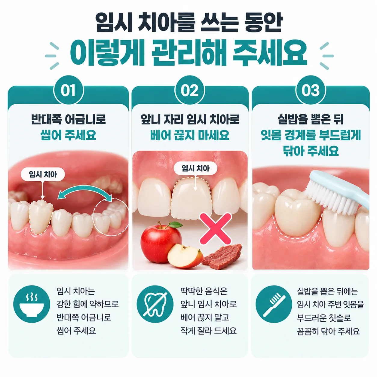 원데이 임플란트 임시 치아를 쓰는 동안의 씹기와 칫솔질 안내 카드