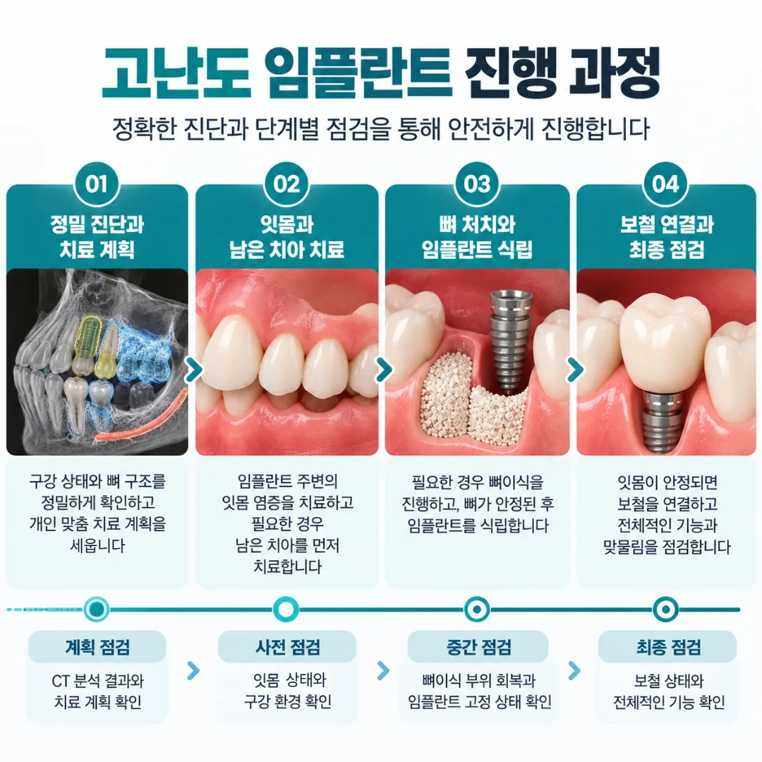 고난도 임플란트를 단계로 나눠 진행하는 일정과 단계 사이 점검 시점 도식