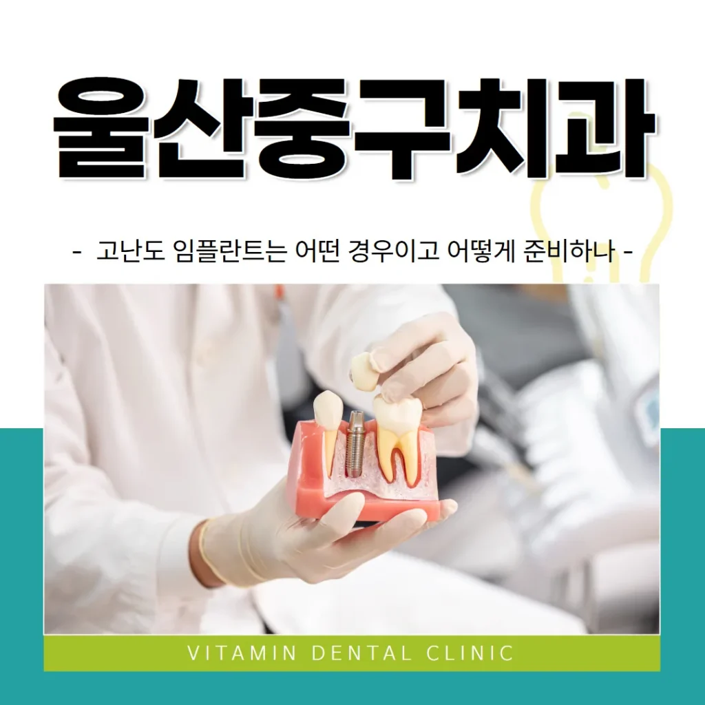 울산중구치과, 고난도 임플란트는 어떤 경우이고 어떻게 준비하나