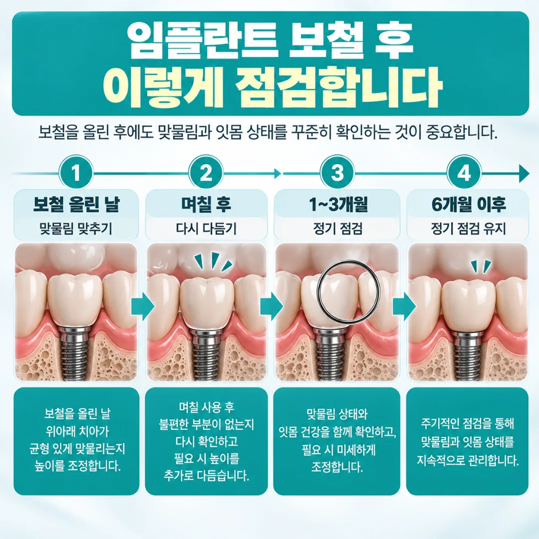 보철을 올린 날의 맞물림 조정부터 며칠 뒤 다시 다듬기, 정기 점검으로 이어지는 시간선 안내도