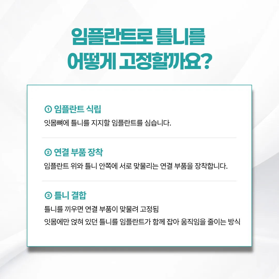임플란트 위 연결 장치에 틀니 안쪽 부품이 끼워져 틀니를 붙잡는 원리를 보여 주는 개념도