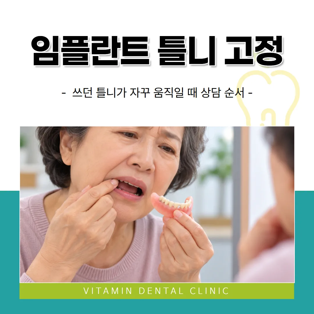 임플란트 틀니 고정, 쓰던 틀니가 자꾸 움직일 때 상담 순서