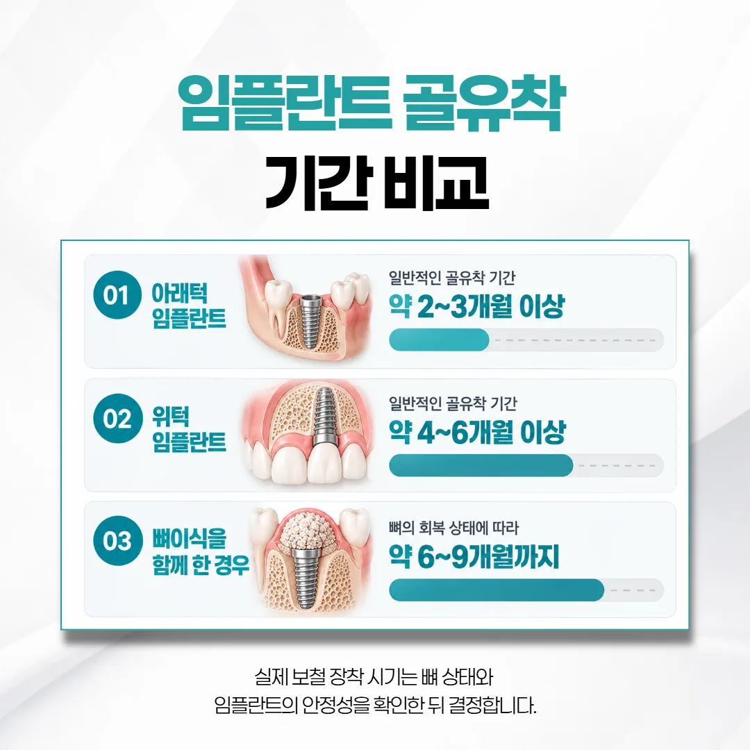 아래턱과 위턱, 뼈 보충 여부에 따라 임플란트가 뼈와 붙는 기간을 견준 개념도