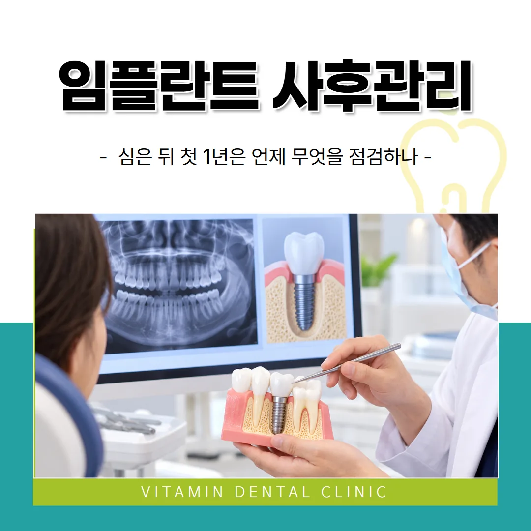 임플란트 사후관리, 심은 뒤 첫 1년은 언제 무엇을 점검하나